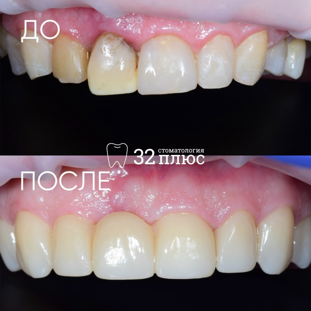 Если вас беспокоит неудовлетворительная эстетика улыбки, все можно изменить!