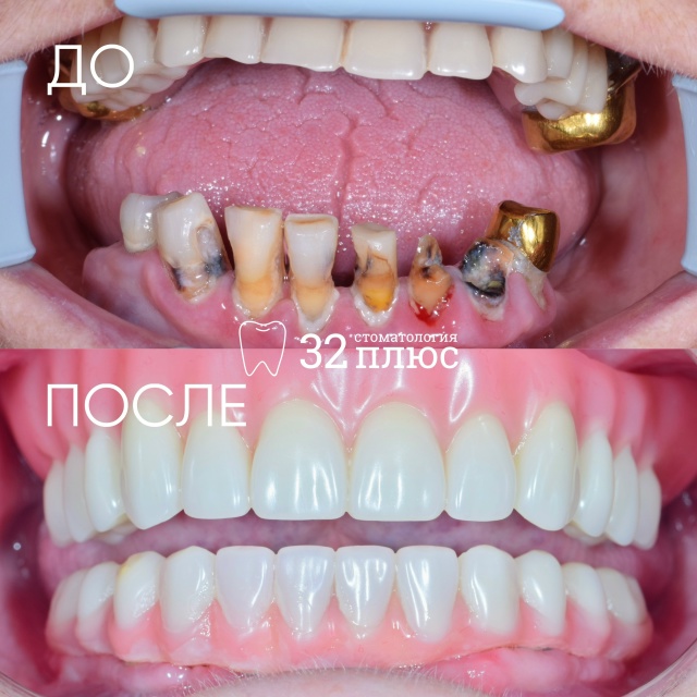 Любите ли вы тотальные преображения так, как любим их мы?