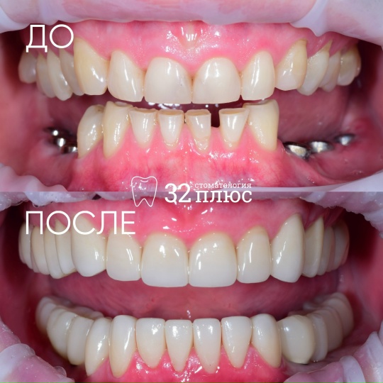 Когда улыбка требует комплексного решения