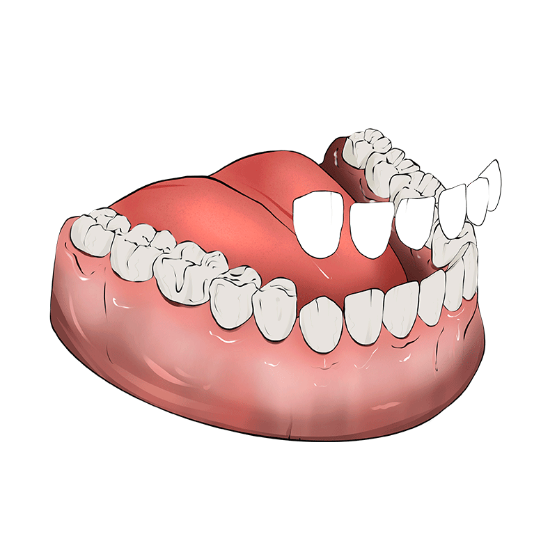 Лечение кариеса зубов (начального, среднего, глубокого) — клиника Grandmed
