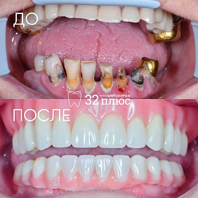 Любите ли вы тотальные преображения так, как любим их мы?