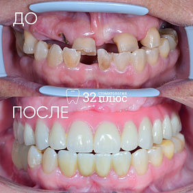 Клинический случай