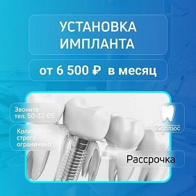 Имплантация за 6500 рублей в месяц.