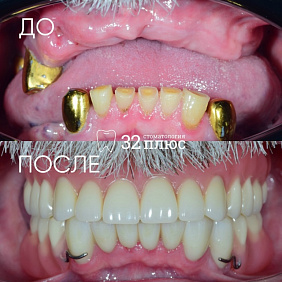 «Я не хочу ставить импланты».