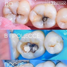 Спасти нельзя удалять